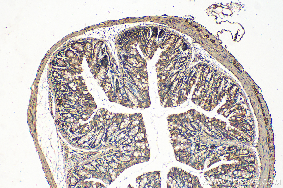 Immunohistochemical analysis of paraffin-embedded mouse colon tissue slide using 20776-1-AP (FAM96A antibody) at dilution of 1:100 (under 10x lens). Heat mediated antigen retrieval with Tris-EDTA buffer (pH 9.0). IHC staining of mouse colon using 20776-1-AP
