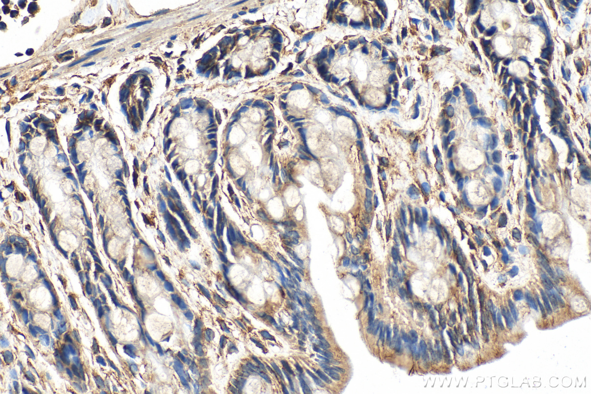 Immunohistochemical analysis of paraffin-embedded rat colon tissue slide using 20776-1-AP (FAM96A antibody) at dilution of 1:100 (under 40x lens). Heat mediated antigen retrieval with Tris-EDTA buffer (pH 9.0). IHC staining of rat colon using 20776-1-AP
