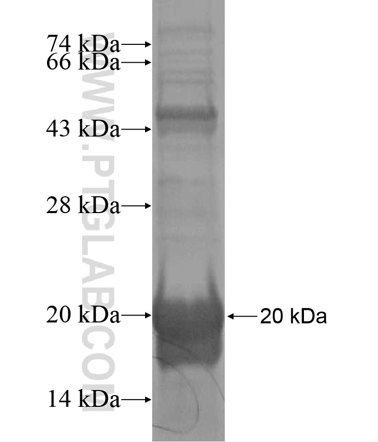 FAM96A fusion protein Ag16959 SDS-PAGE FAM96A fusion protein Ag16959 SDS-PAGE