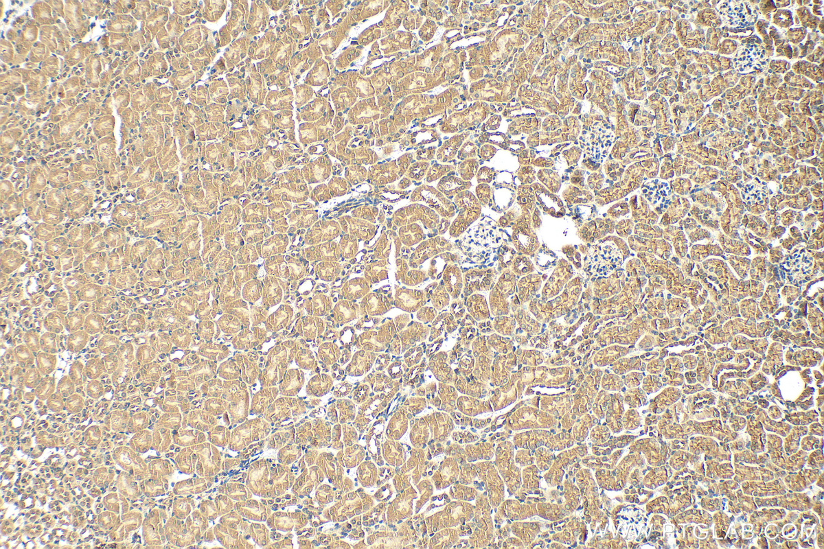 IHC staining of mouse kidney using 20108-1-AP