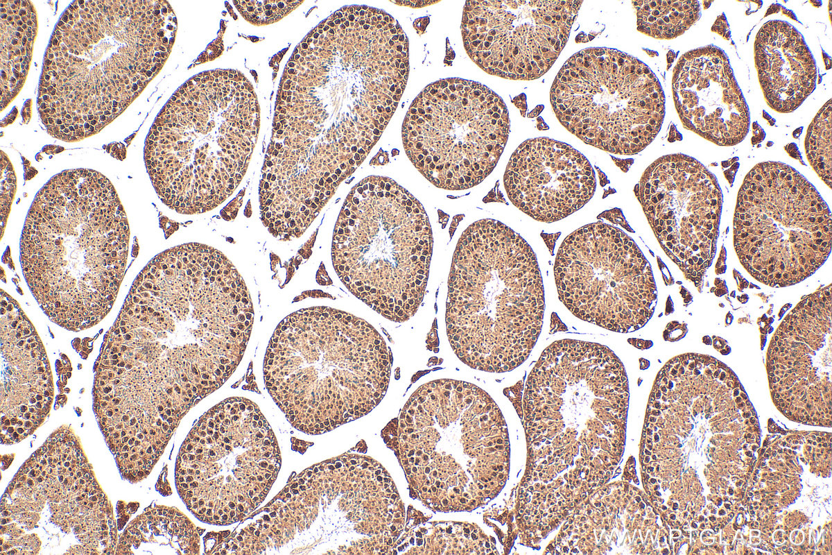 IHC staining of mouse testis using 22251-1-AP