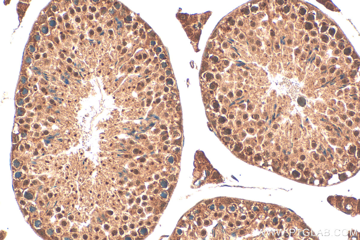 IHC staining of mouse testis using 22251-1-AP