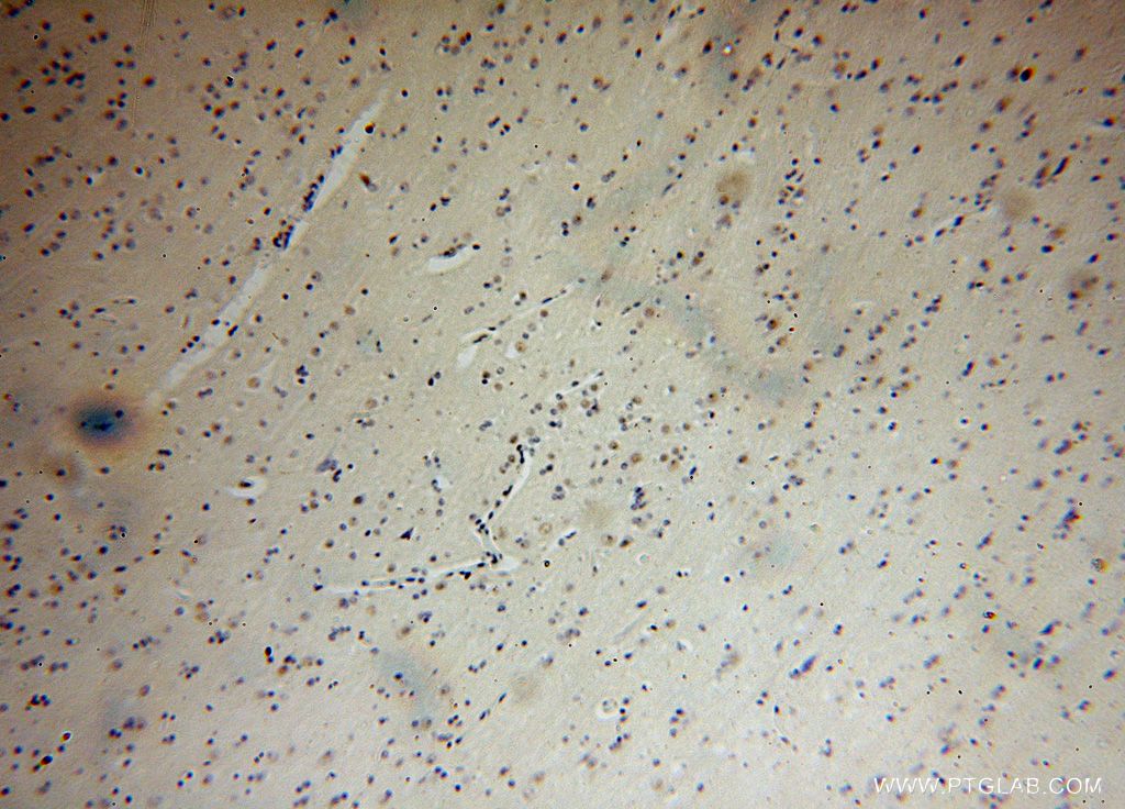 IHC staining of human brain using 16973-1-AP