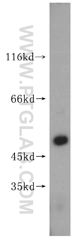 WB analysis of HepG2 using 16973-1-AP