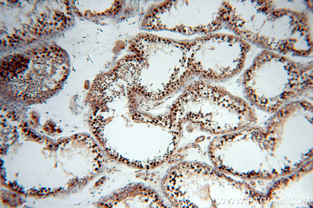 IHC staining of human testis using 19543-1-AP