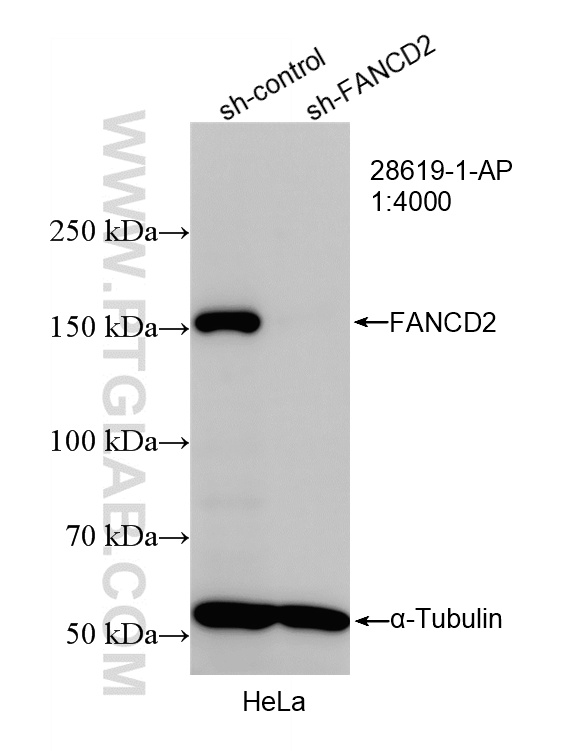 WB result of FANCD2 antibody (28619-1-AP; 1:4000; incubated at room temperature for 1.5 hours) with sh-Control and sh-FANCD2 transfected HeLa cells. WB analysis of HeLa using 28619-1-AP