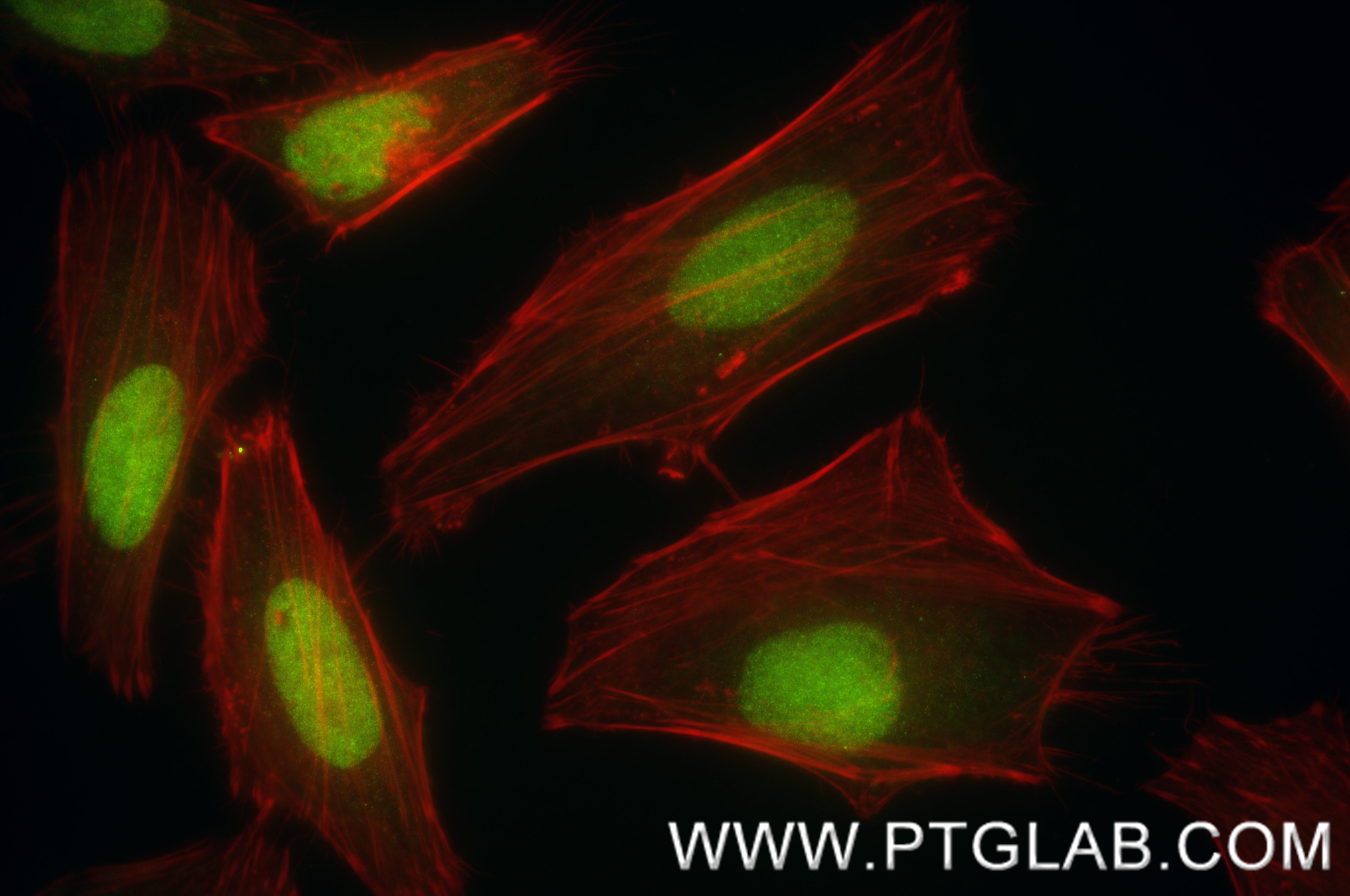 IF Staining of HeLa using 83946-4-RR