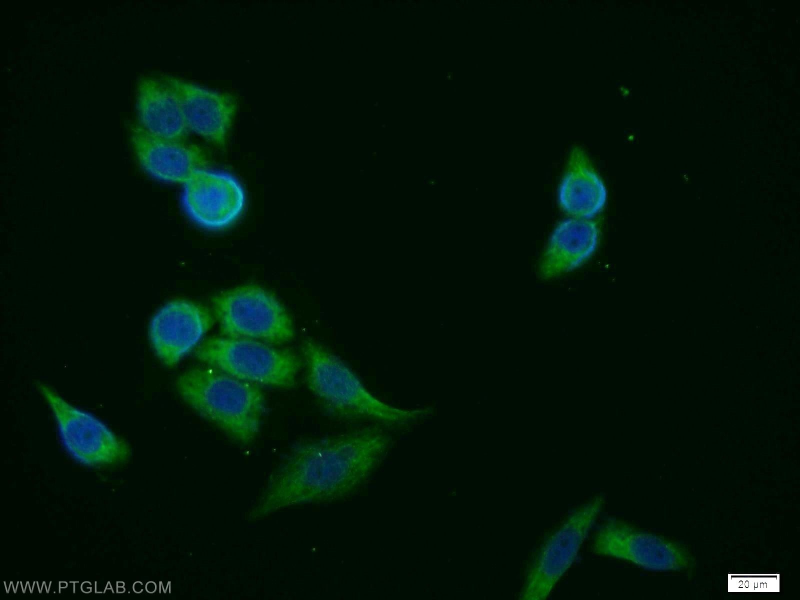 IF Staining of HeLa using 10215-1-AP