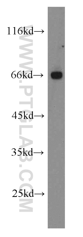 WB analysis of Jurkat using 10215-1-AP