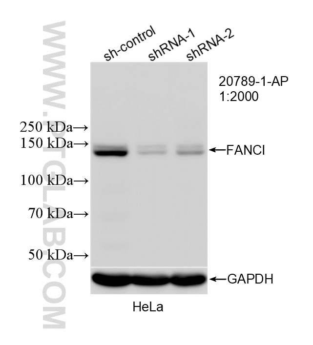 WB result of FANCI antibody (20789-1-AP; 1:2000; incubated at room temperature for 1.5 hours) with sh-Control and sh-FANCI transfected HeLa cells. WB analysis of HeLa using 20789-1-AP
