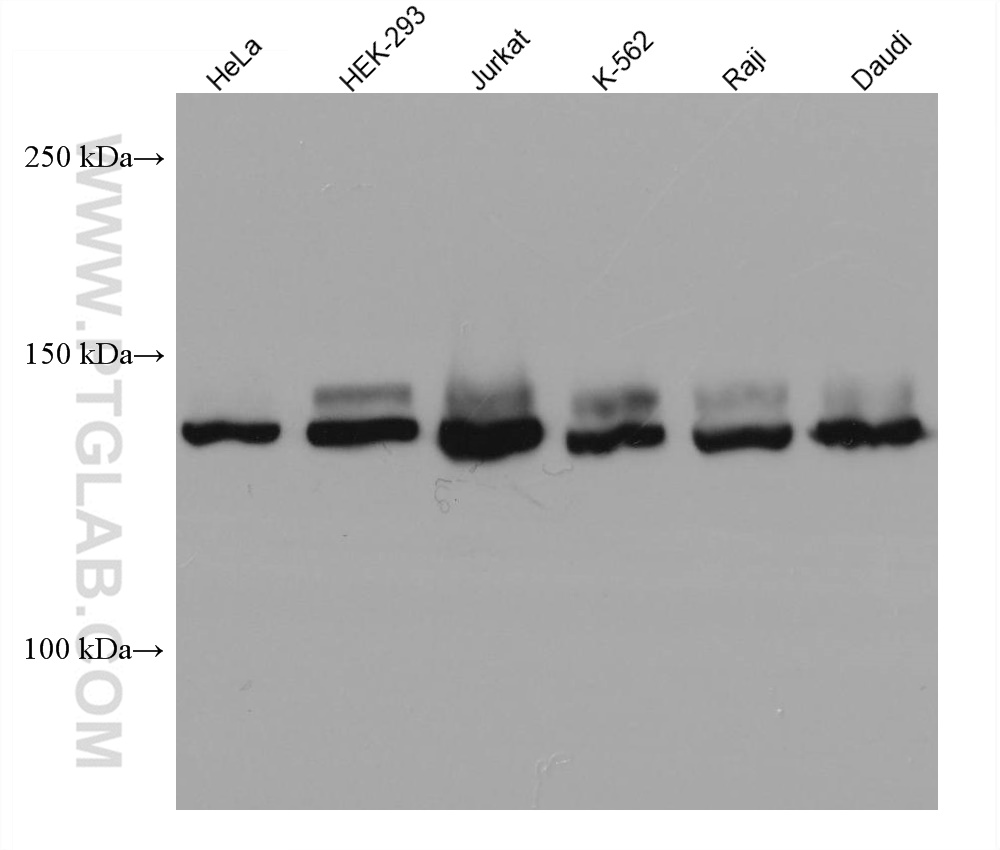 WB analysis using 67304-1-Ig