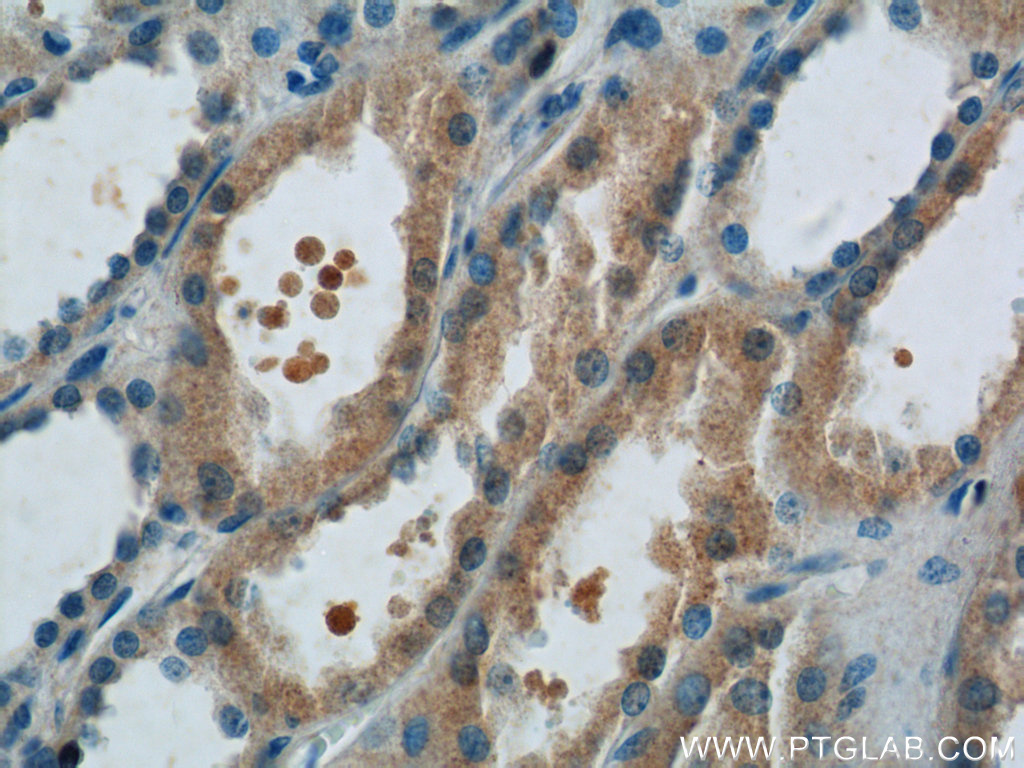 IHC staining of human kidney using 14454-1-AP