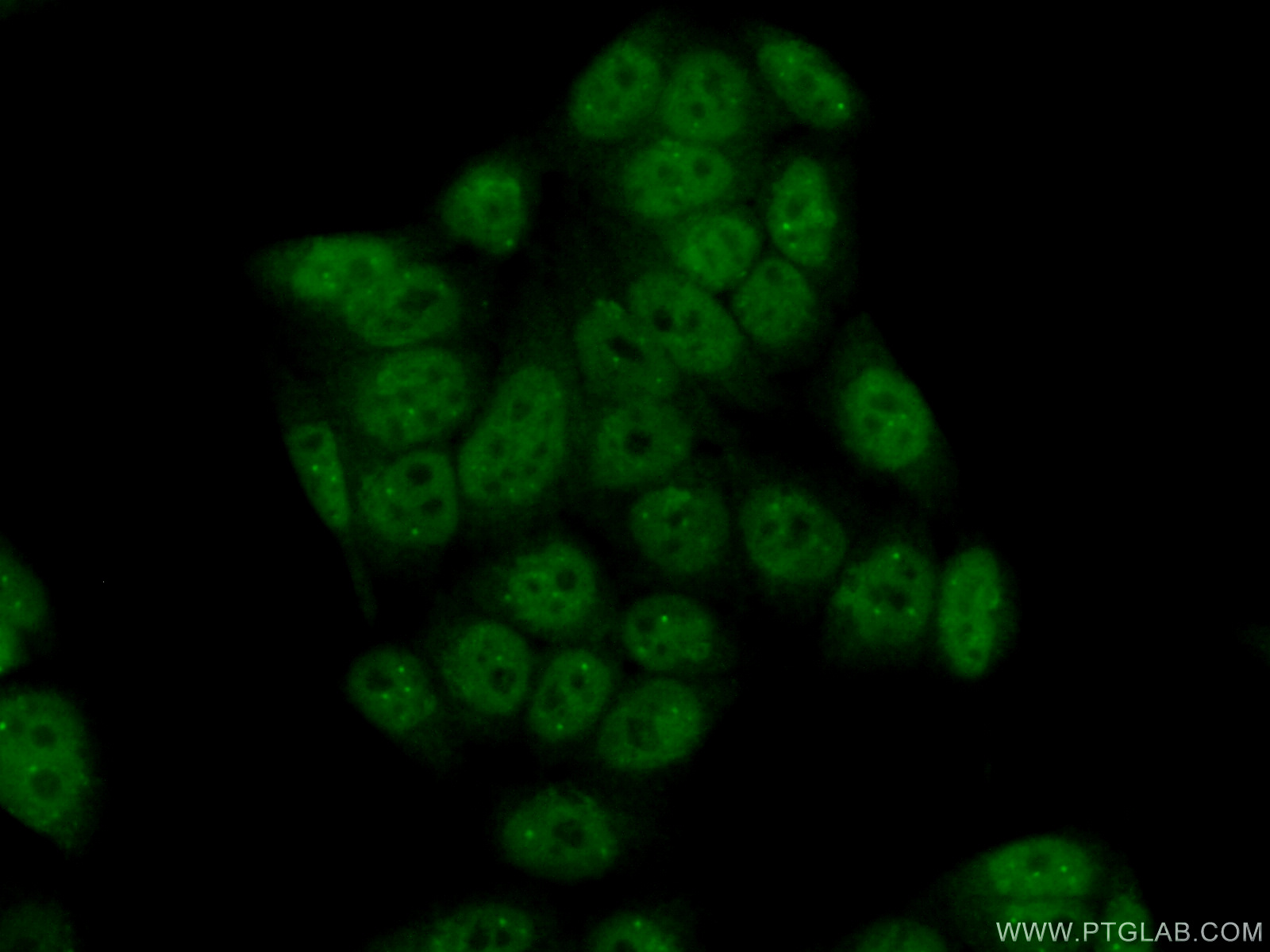 IF Staining of HeLa using 12954-1-AP