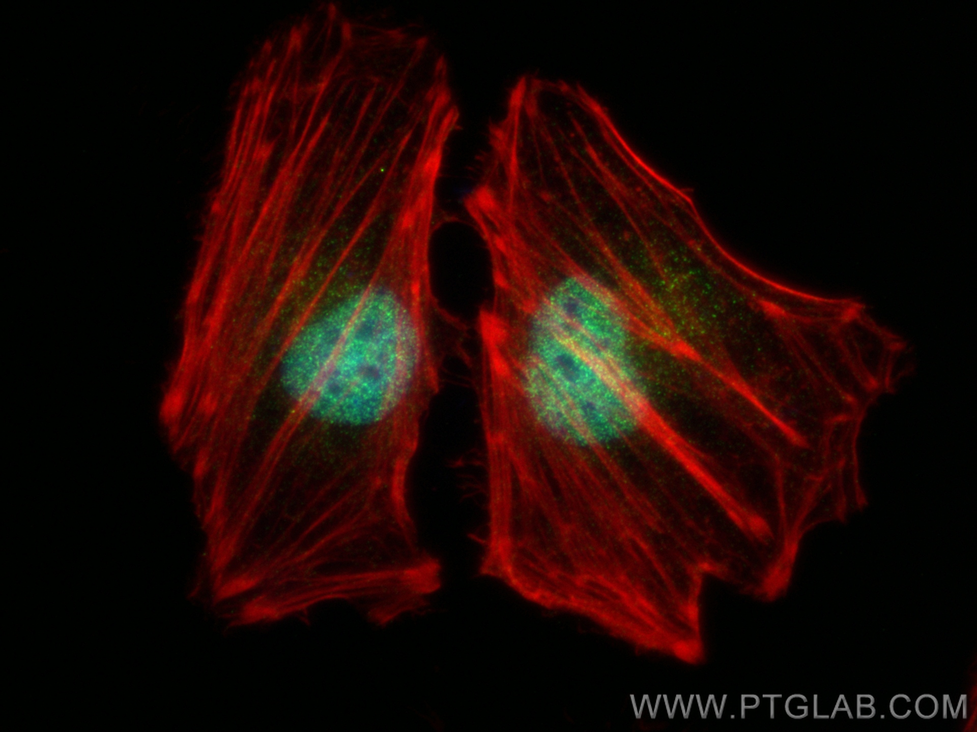 IF Staining of HeLa using 82897-1-RR