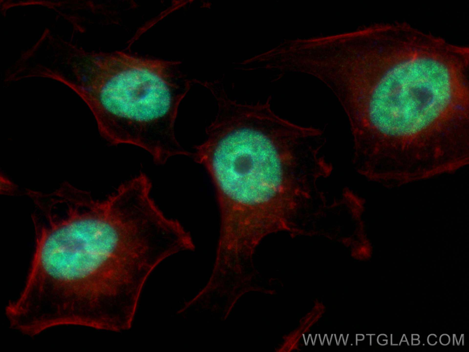 IF Staining of HeLa using 82897-2-RR