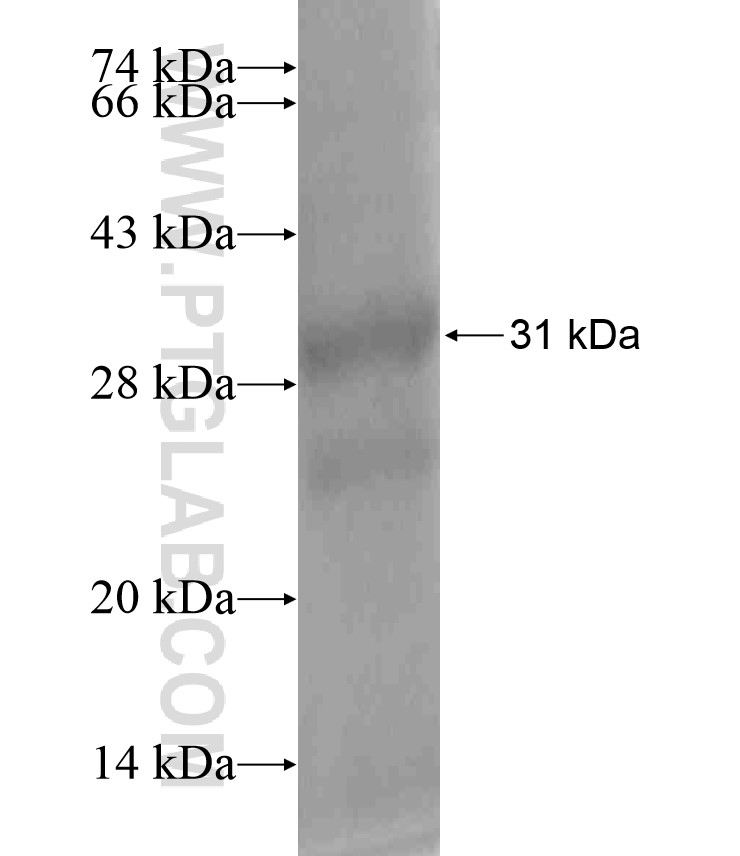 FAR2 fusion protein Ag18444 SDS-PAGE FAR2 fusion protein Ag18444 SDS-PAGE