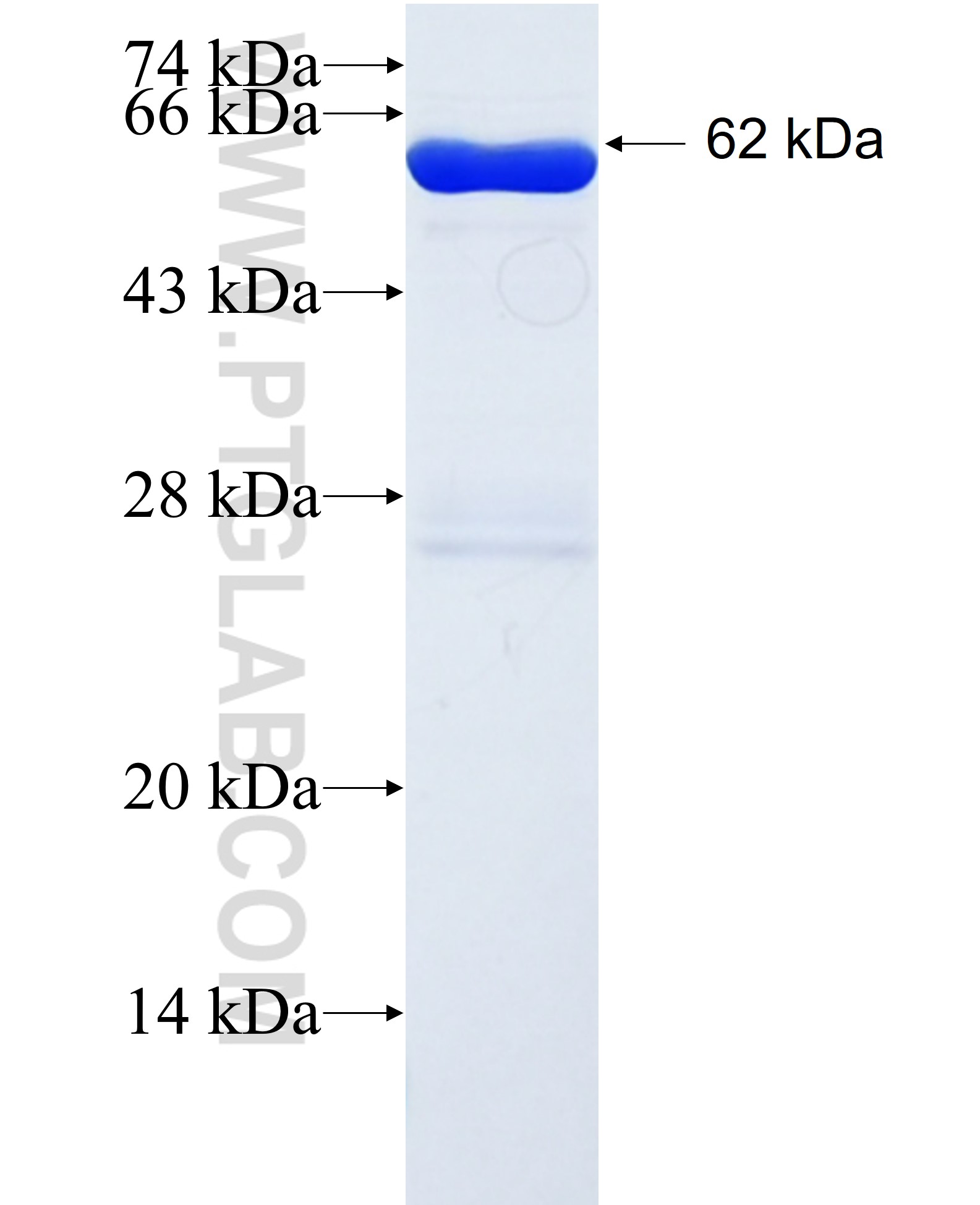 FARP2 fusion protein Ag1990 SDS-PAGE FARP2 fusion protein Ag1990 SDS-PAGE