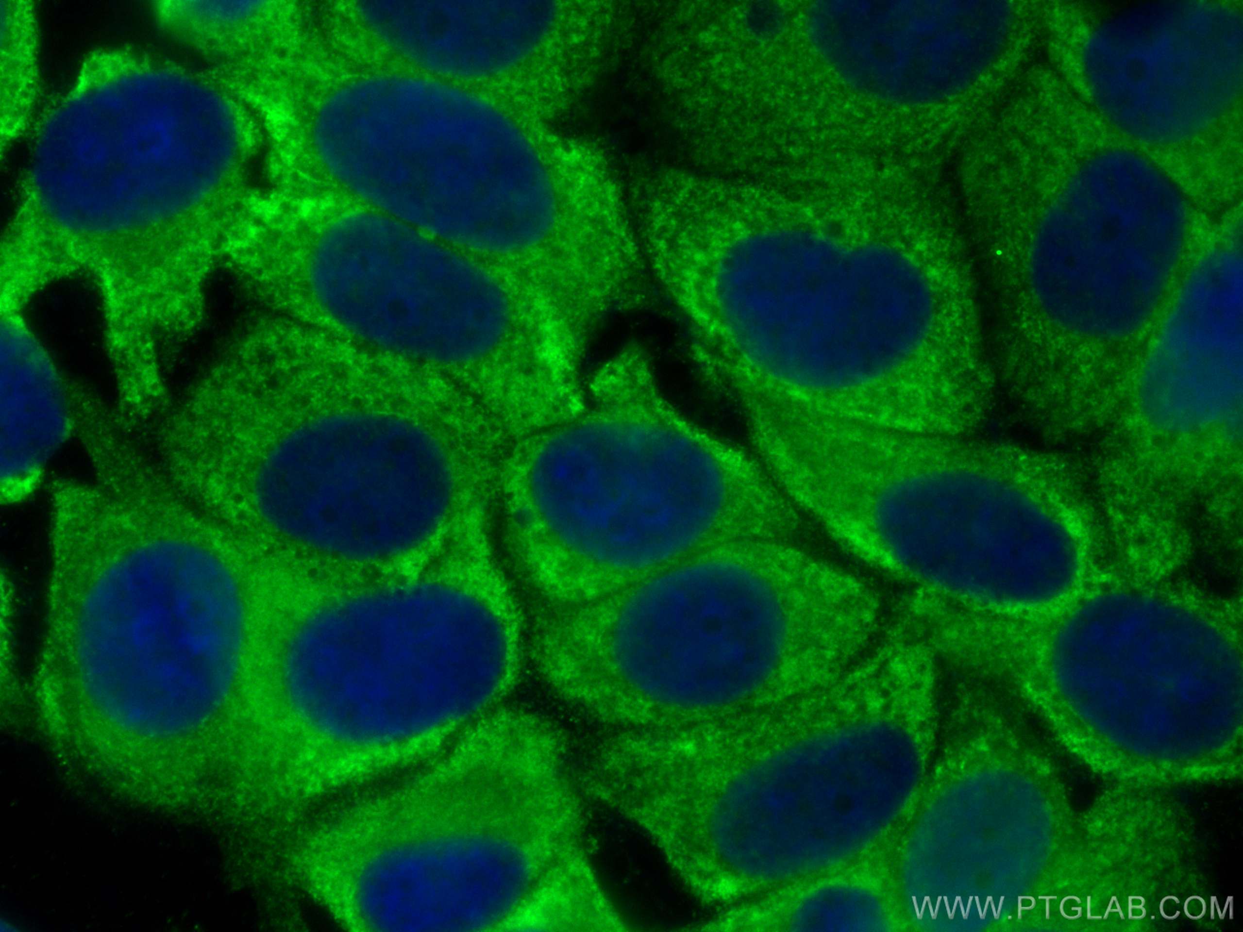 IF Staining of MCF-7 using 18121-1-AP (same clone as 18121-1-PBS)
