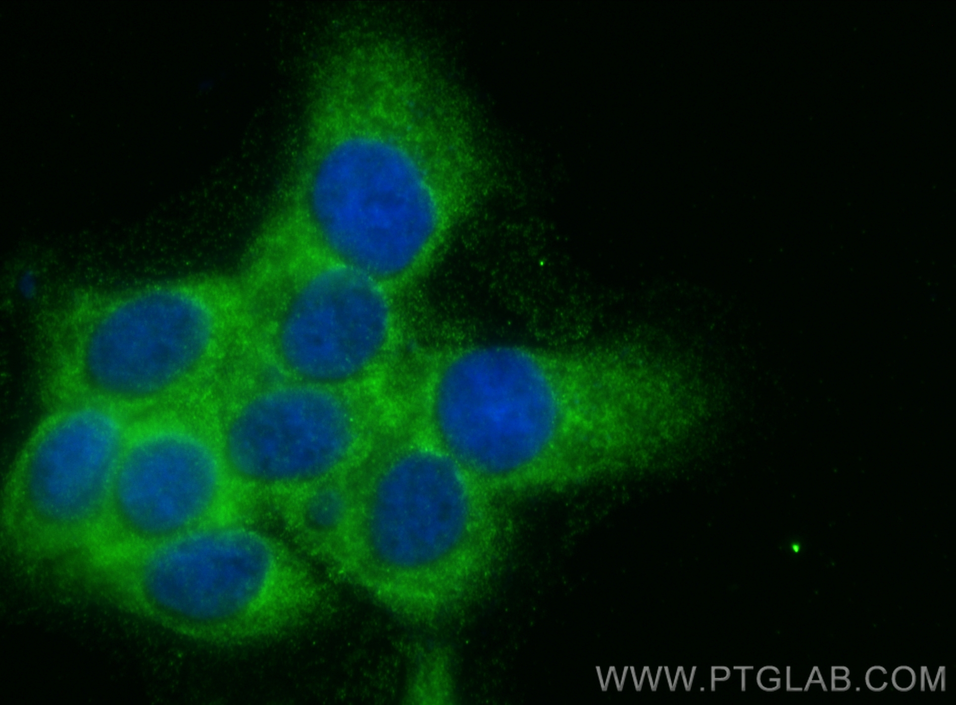 IF Staining of A431 using 67945-1-Ig (same clone as 67945-1-PBS)