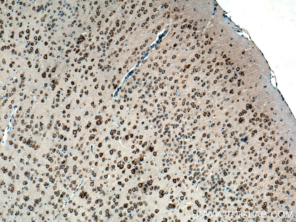 IHC staining of mouse brain using 16341-1-AP