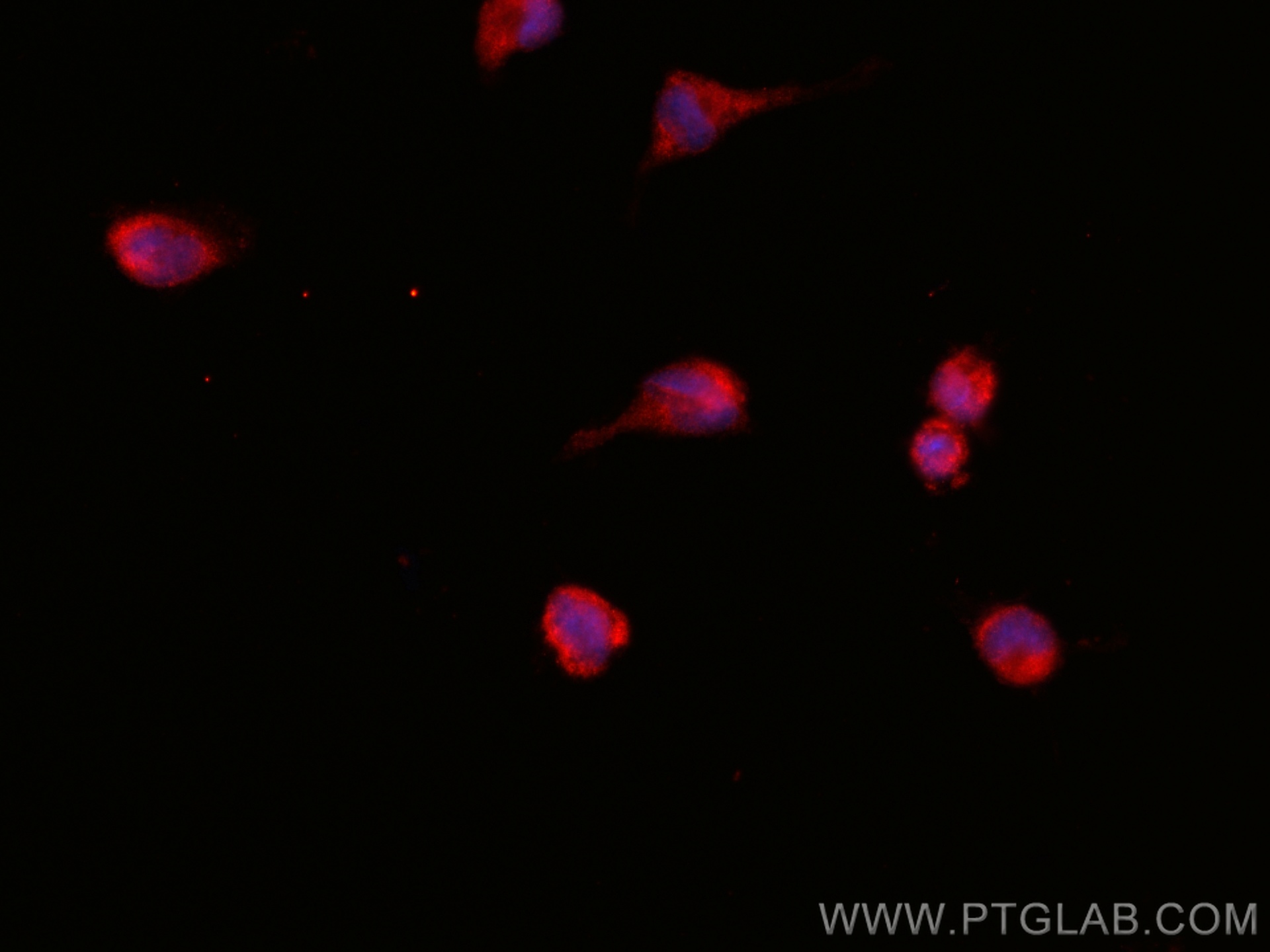 IF Staining of U-251 using CL594-67924