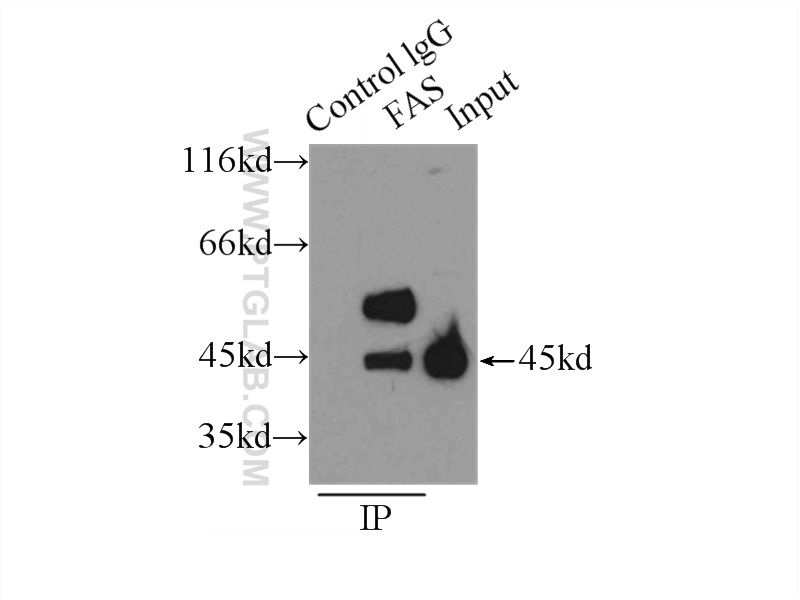 IP experiment of HeLa using 13098-1-AP