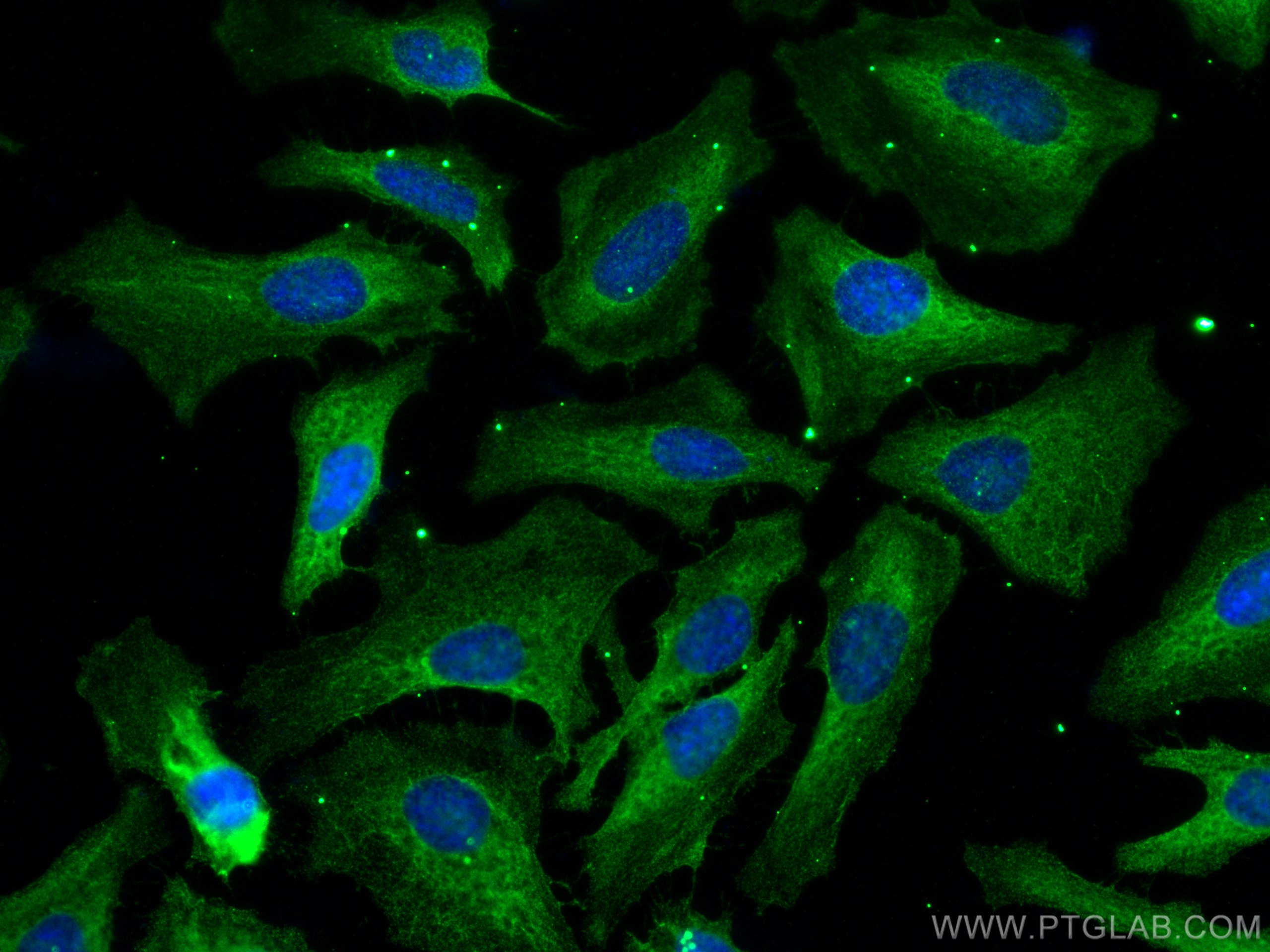 IF Staining of HeLa using 66591-1-Ig (same clone as 66591-1-PBS)