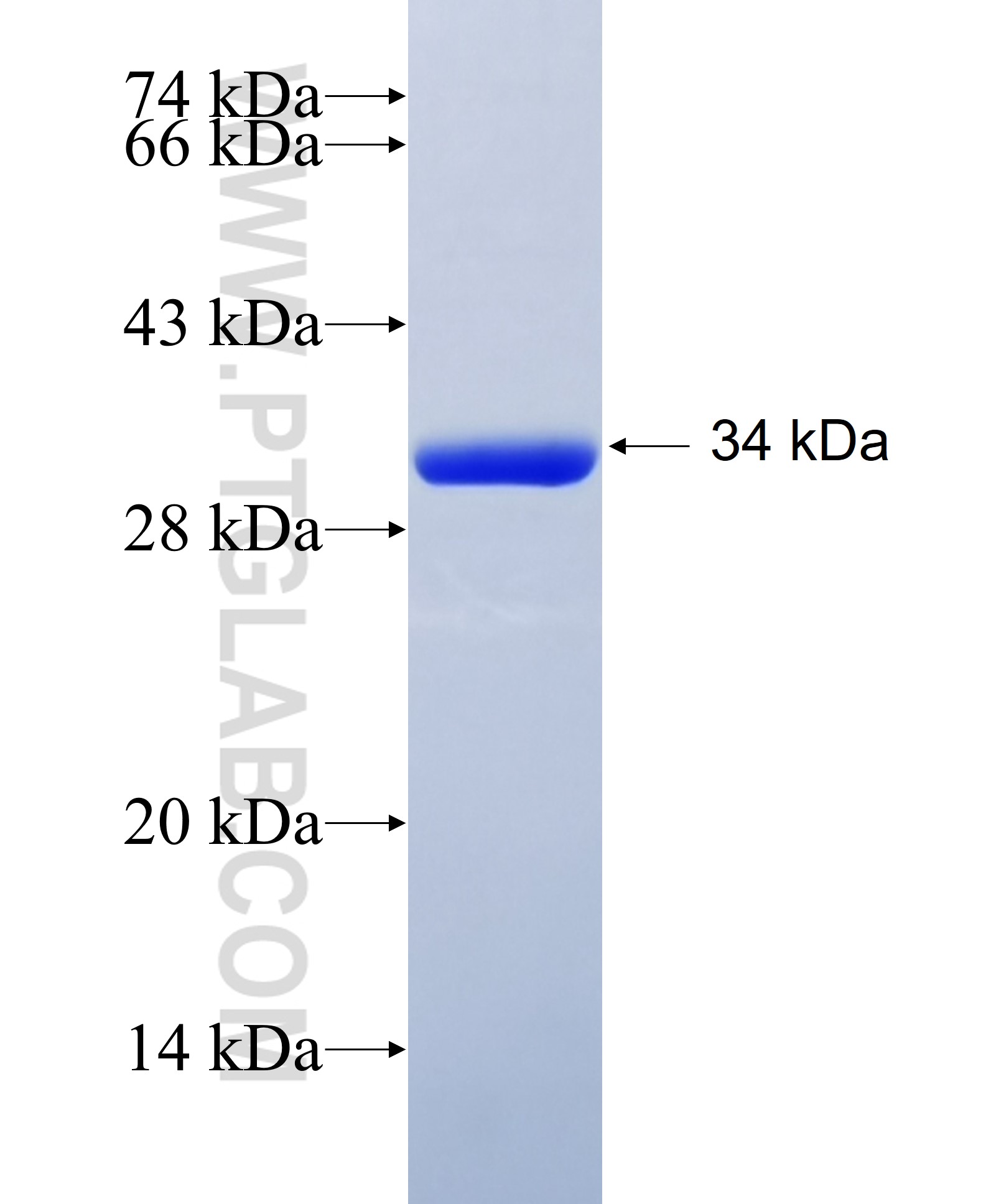 FASN fusion protein Ag27077 SDS-PAGE