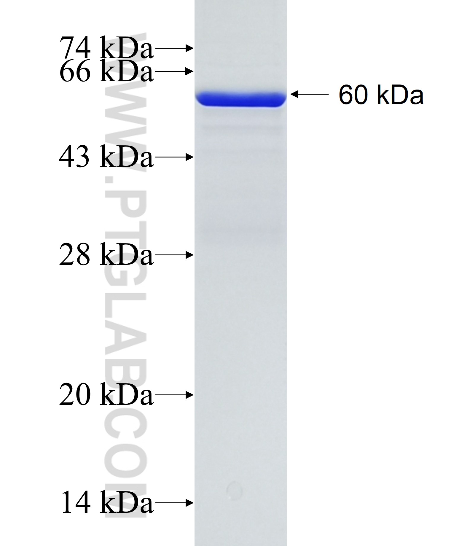 FASTKD2 fusion protein Ag11289 SDS-PAGE