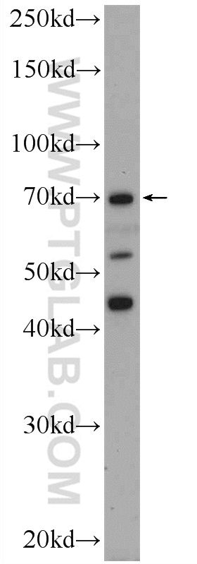 WB analysis of HepG2 using 18392-1-AP