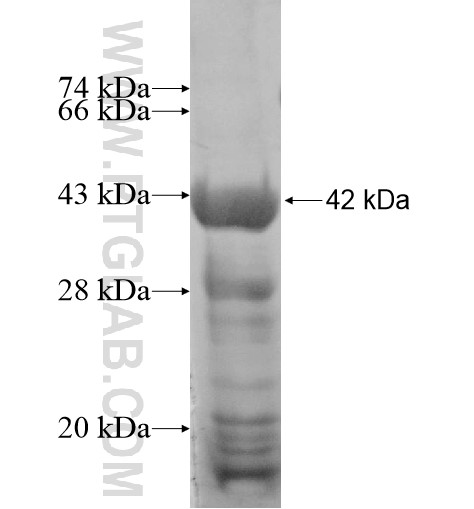 FASTKD5 fusion protein Ag14725 SDS-PAGE FASTKD5 fusion protein Ag14725 SDS-PAGE