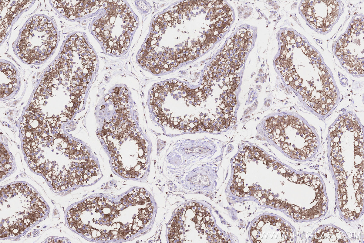 IHC staining of human testis using 23809-1-AP