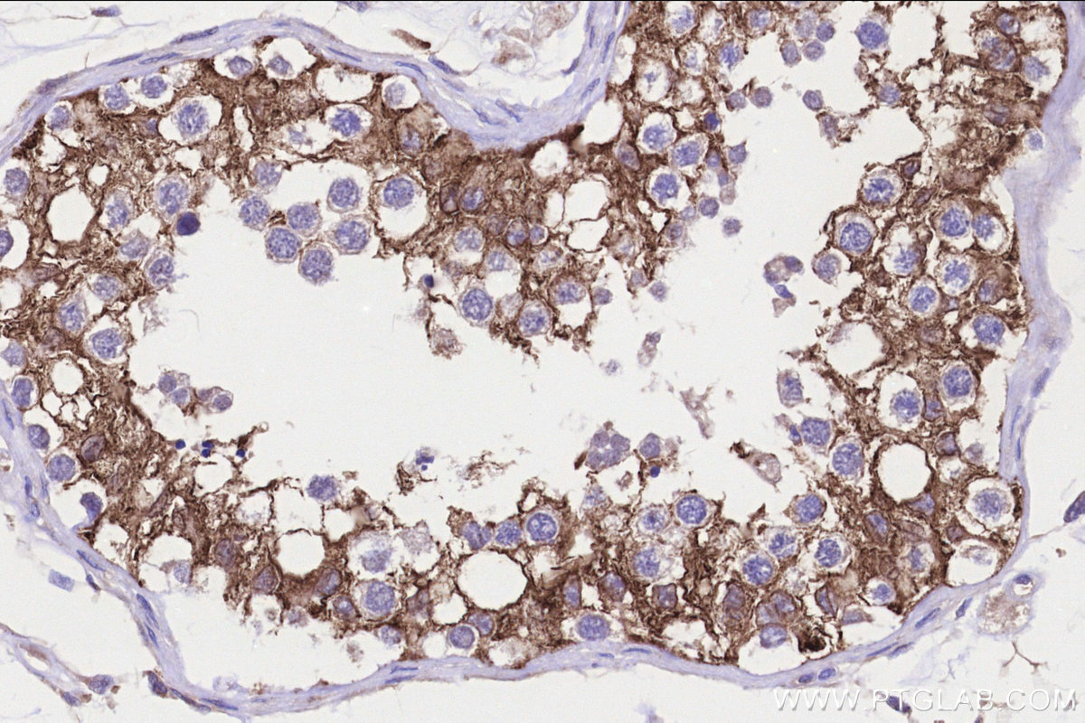 IHC staining of human testis using 23809-1-AP