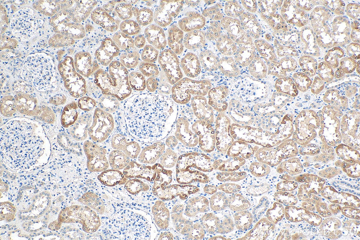 IHC staining of human kidney using 68074-1-Ig