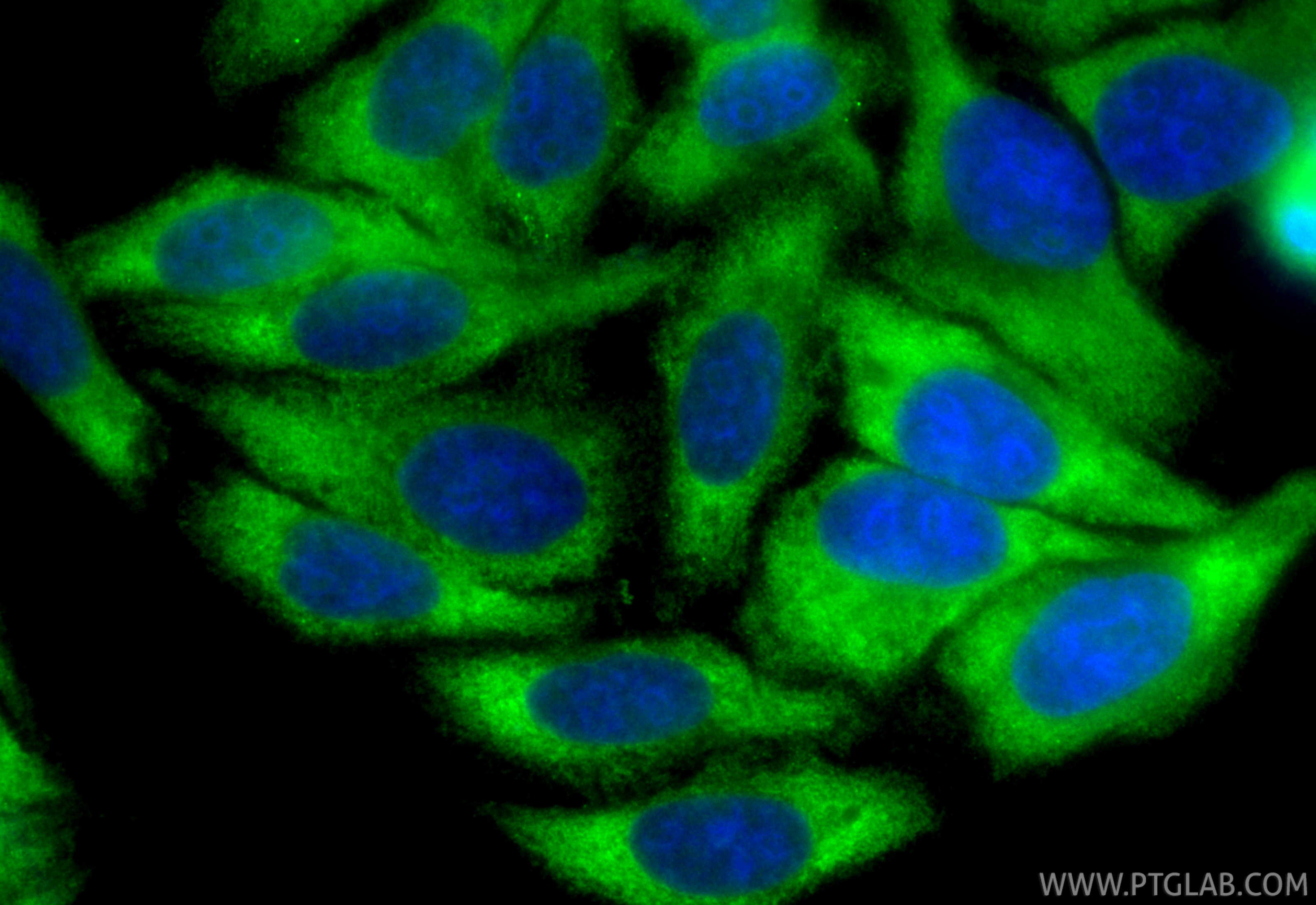 IF Staining of HepG2 using CL488-14048 IF Staining of HepG2 using CL488-14048