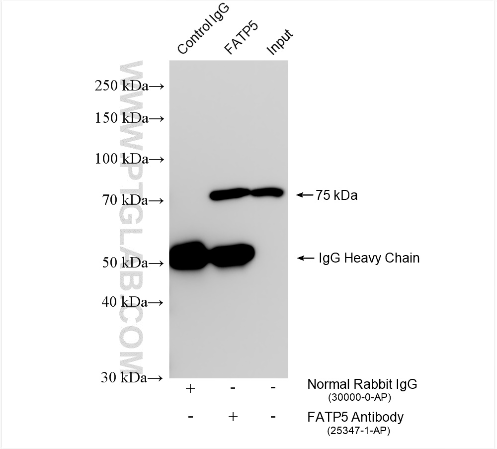 IP experiment of rat liver using 25347-1-AP