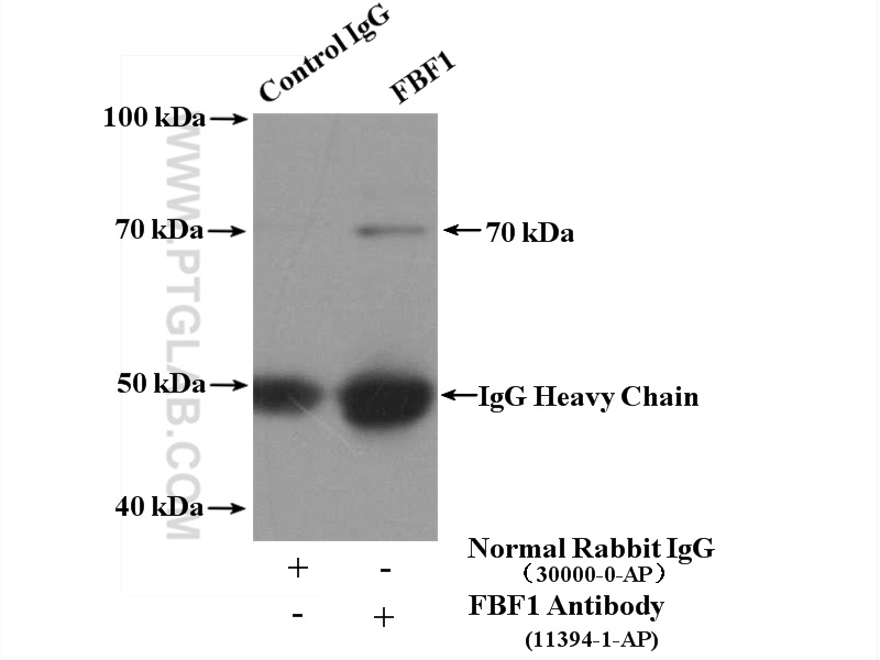 IP experiment of mouse brain using 11394-1-AP