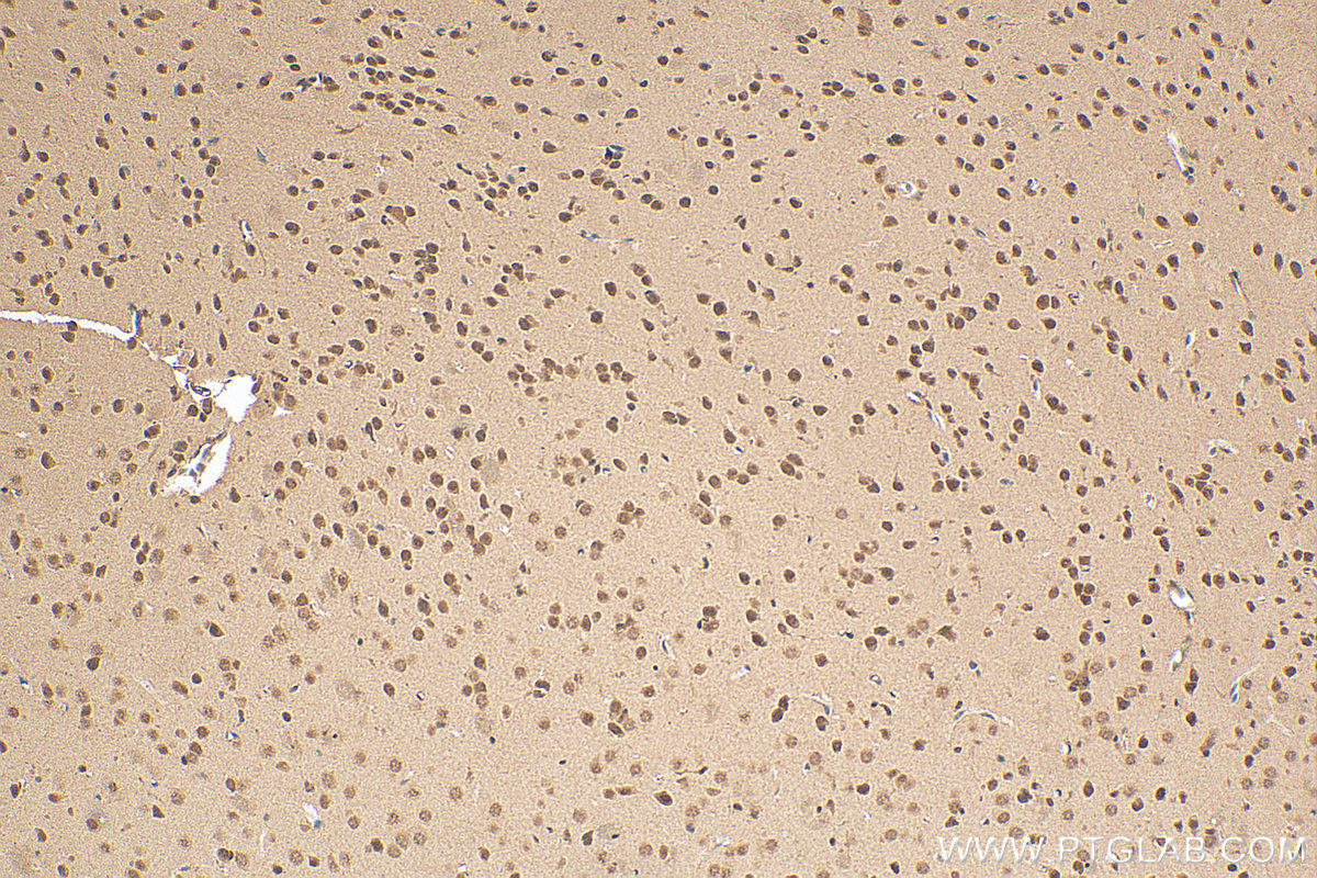 IHC staining of mouse brain using 16021-1-AP