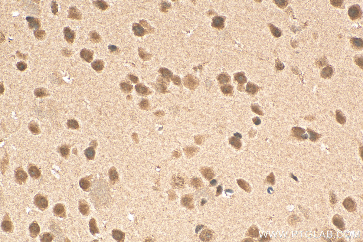 IHC staining of mouse brain using 16021-1-AP