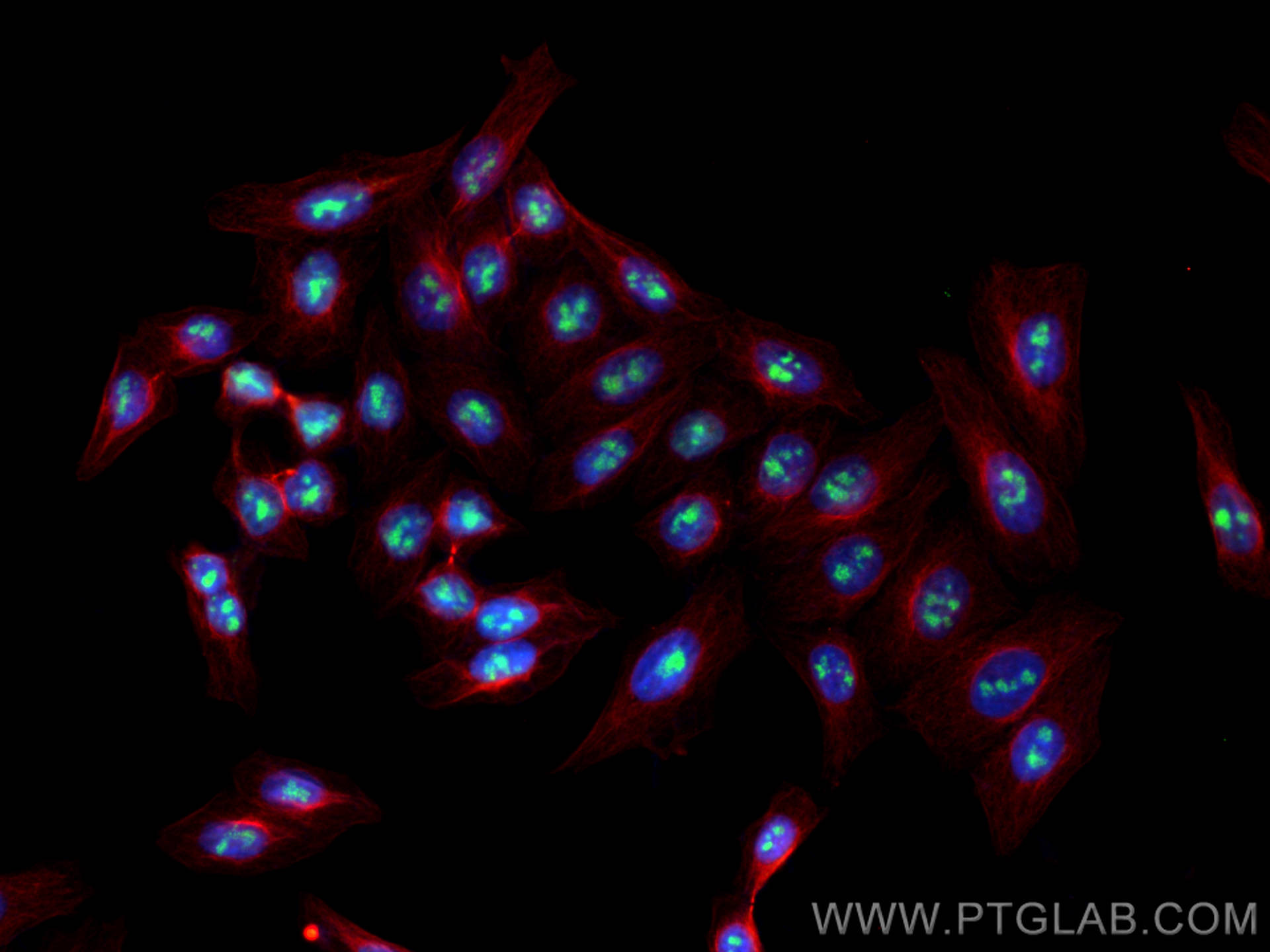 IF Staining of HepG2 using 66985-1-Ig