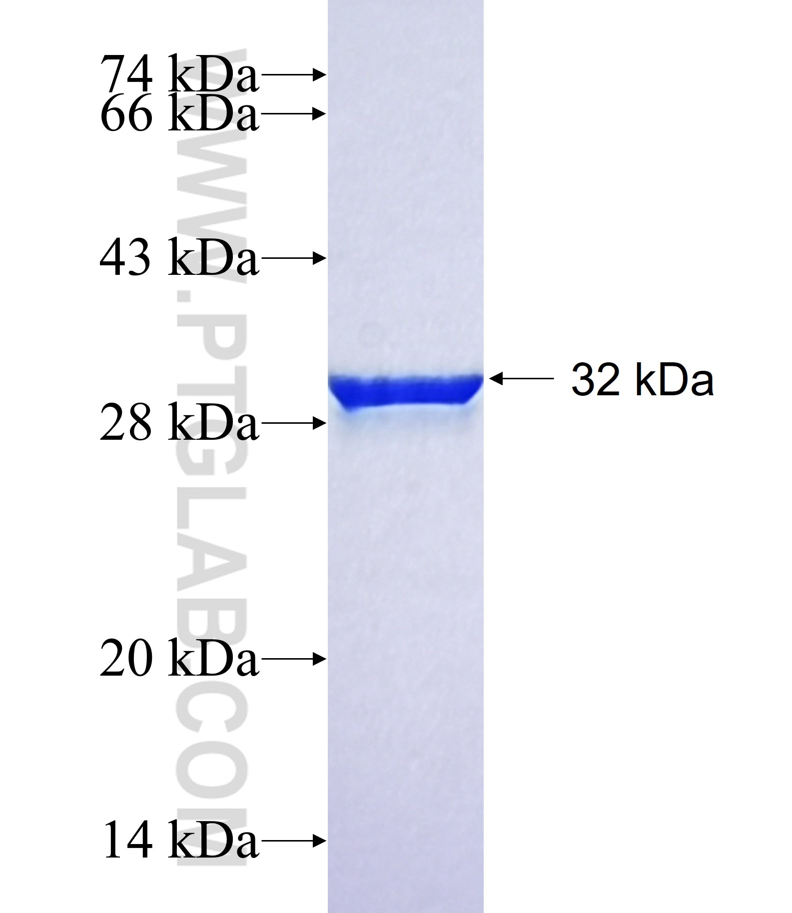 FBLL1 fusion protein Ag40878 SDS-PAGE FBLL1 fusion protein Ag40878 SDS-PAGE