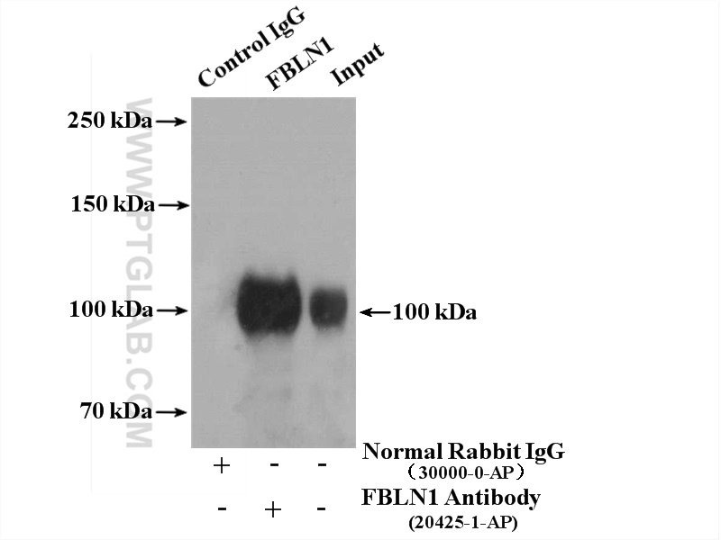 Fibulin-1