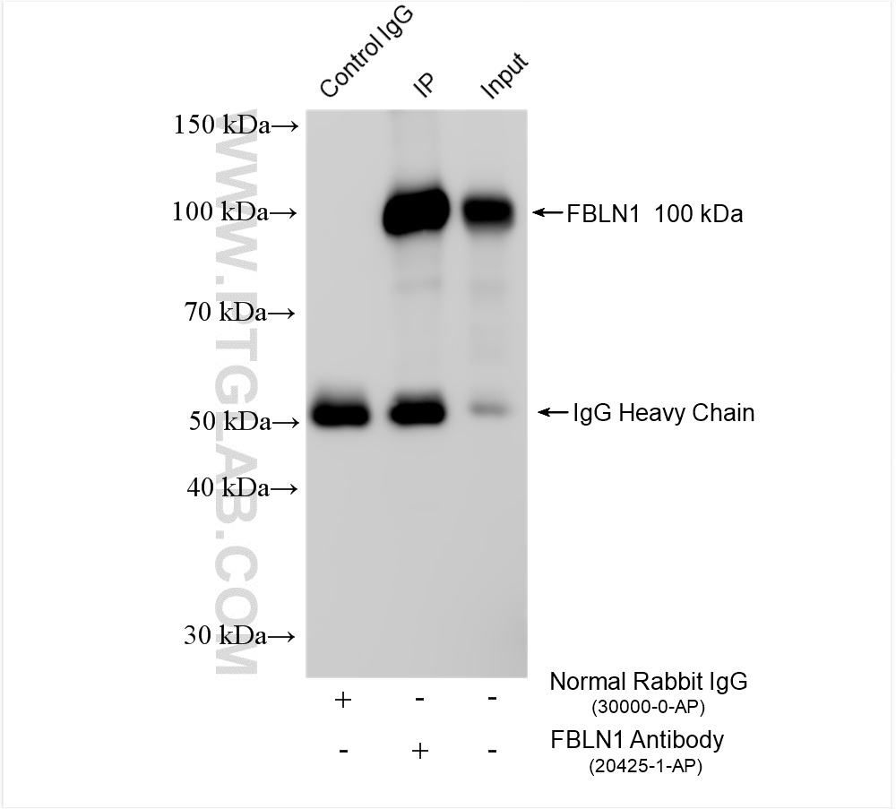 IP experiment of human placenta using 20425-1-AP