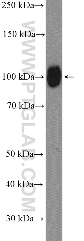 WB analysis of human placenta using 20425-1-AP