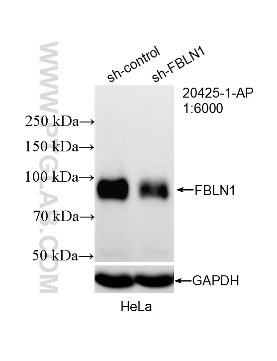 WB analysis of HeLa using 20425-1-AP WB analysis of HeLa using 20425-1-AP