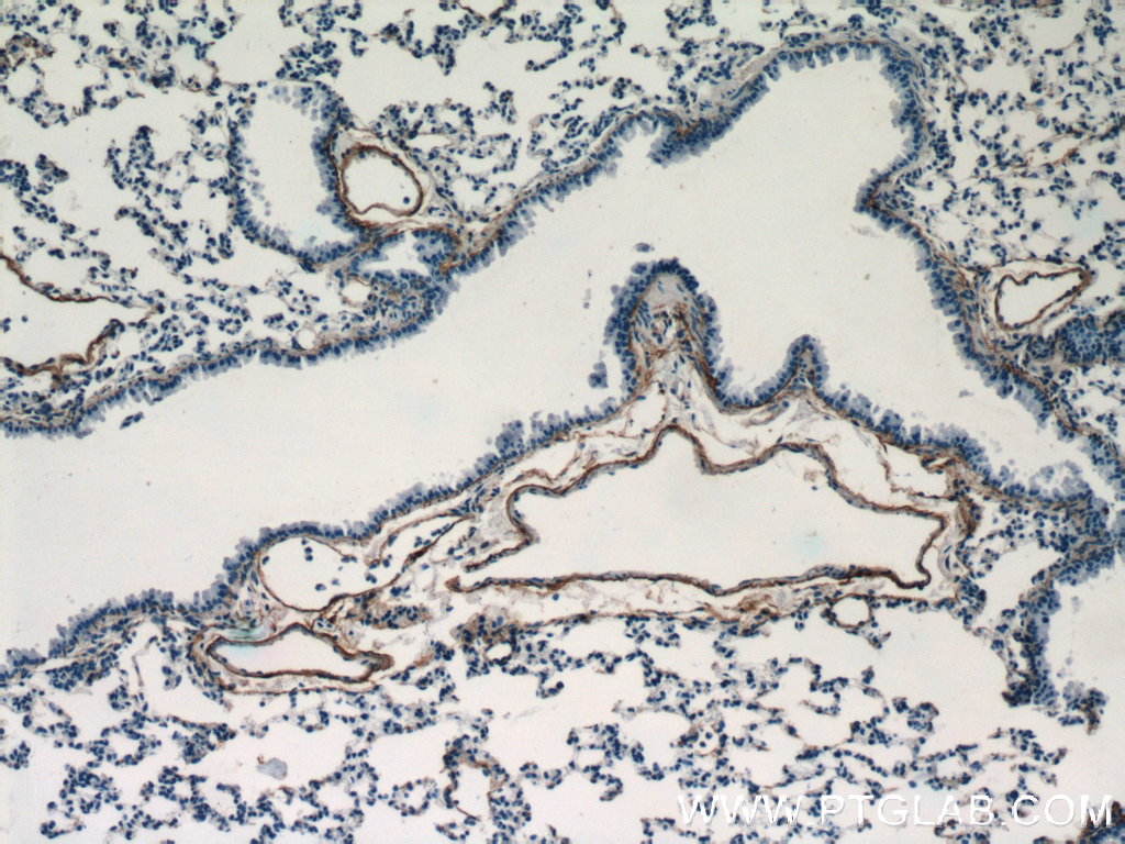 IHC staining of mouse lung using 12188-1-AP