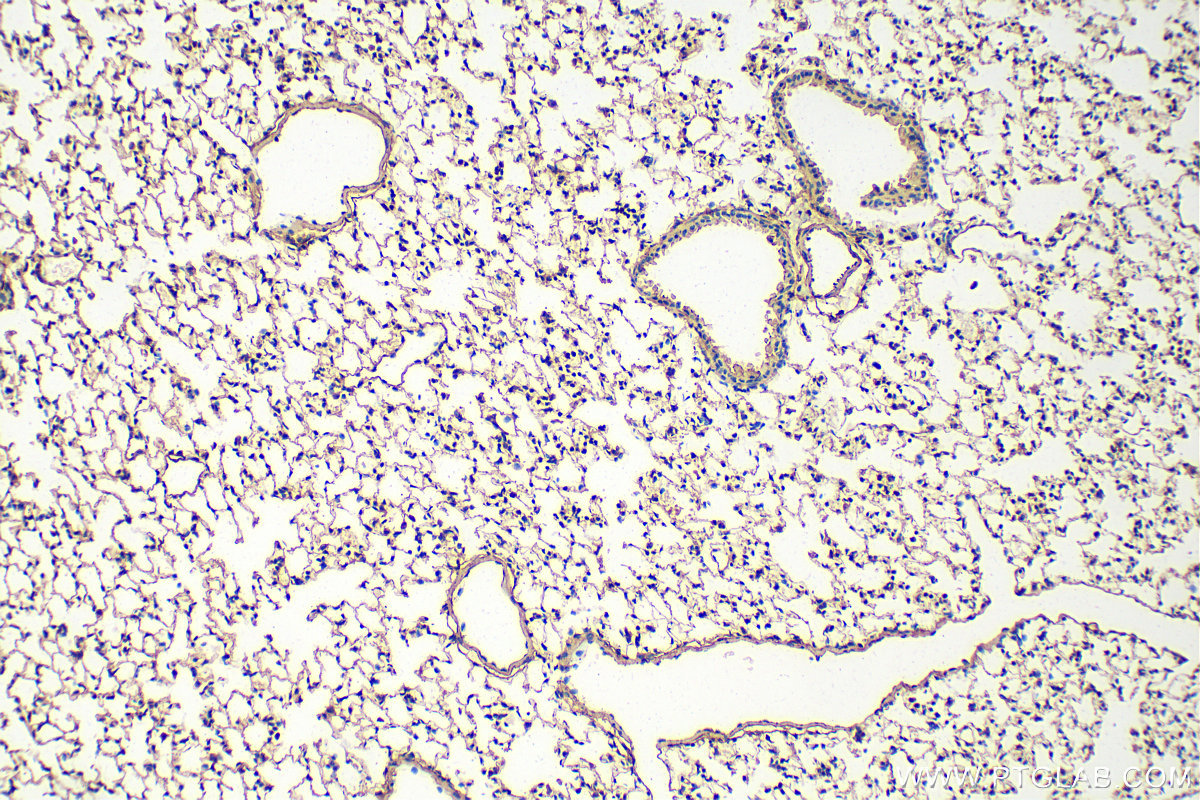 IHC staining of mouse lung using 29992-1-AP