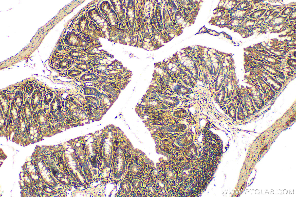 IHC staining of mouse colon using 29992-1-AP (same clone as 29992-1-PBS)