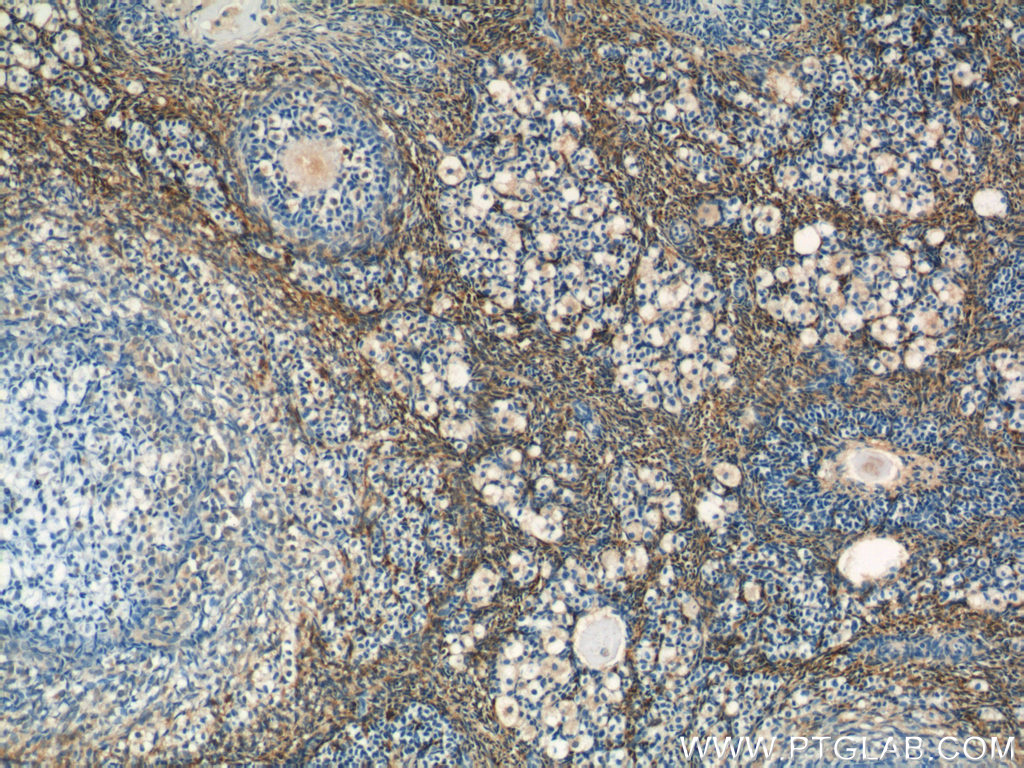 IHC staining of human ovary using 20251-1-AP