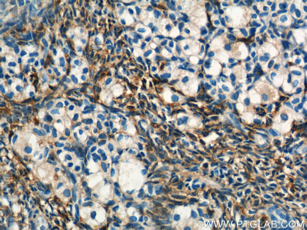 IHC staining of human ovary using 20251-1-AP